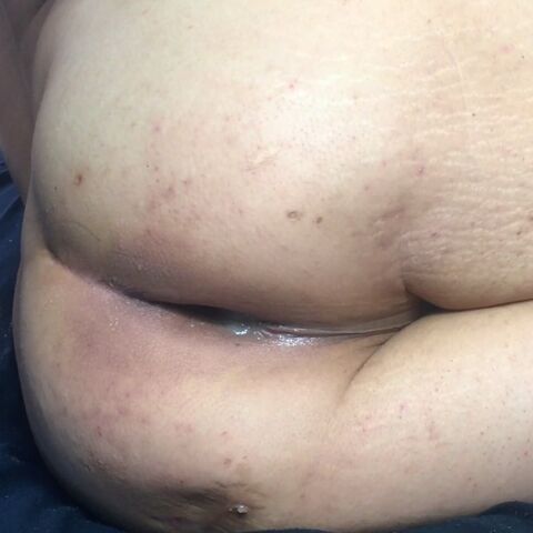 Goldenboy Privat