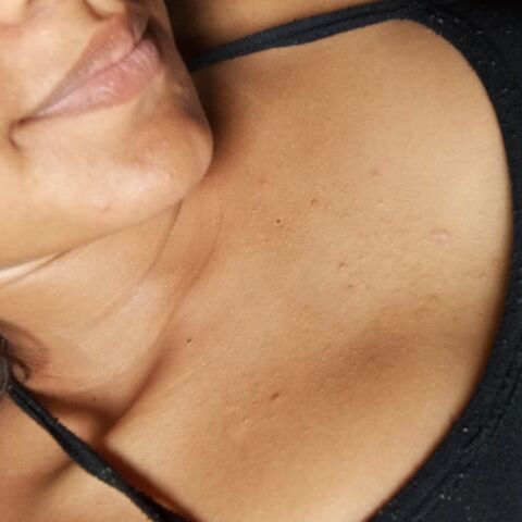 Leitomiss