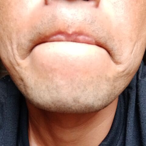 Iclik