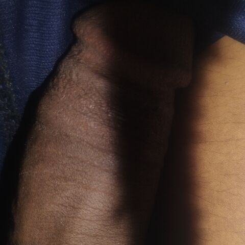Black panic
