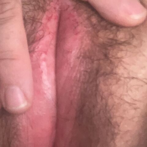 DNIS86