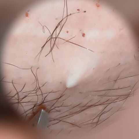 SatisfyingDillyDally