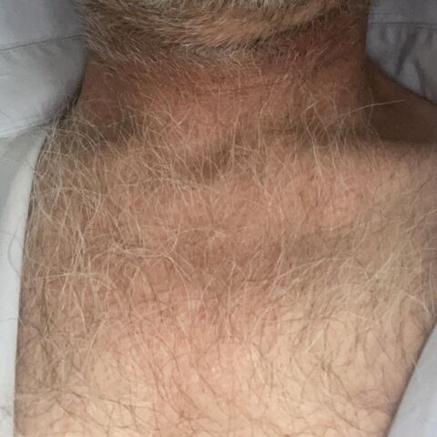 ButNakedone
