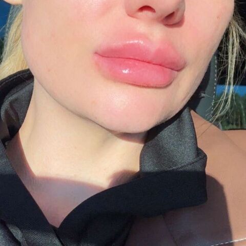 Elsa Lips