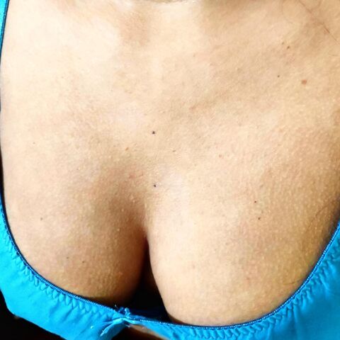 Tanila Dx